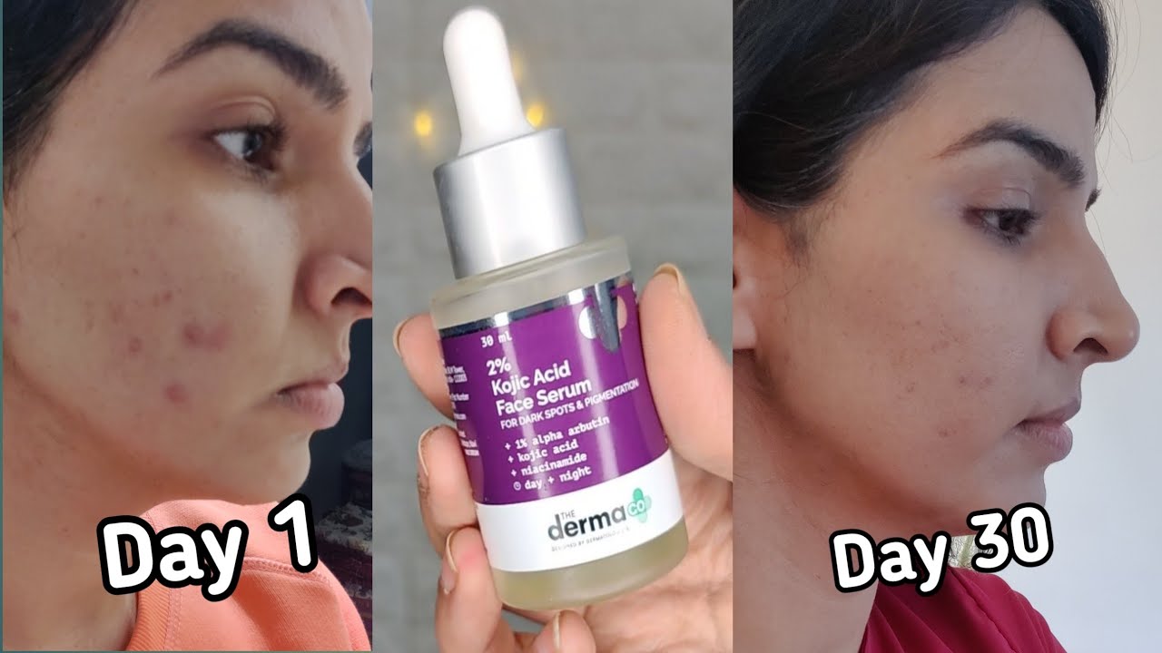 The Derma Co 2% Kojic Acid Face Serum With 1% Alpha Arbutin & Niacinamide For Dark Spot and Pigmentation,  30 Ml