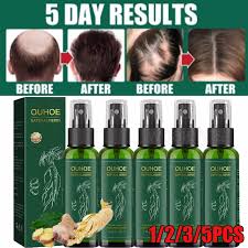 OUHOE Powerful Hair Growth Oil Prevent Hair Loss Products Essence Neo Genuine Ginseng Extract Hair Growth Spray Hair Anti-Fall