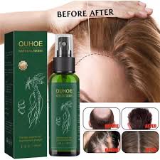 OUHOE Powerful Hair Growth Oil Prevent Hair Loss Products Essence Neo Genuine Ginseng Extract Hair Growth Spray Hair Anti-Fall