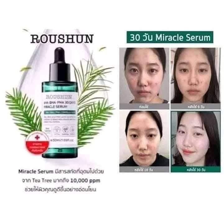 ROUSHUN AHA BHA PHA 30 DAYS MIRACLE SERUM (50ML)